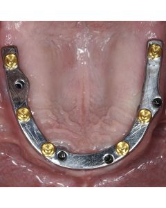 Making Breakthroughs in Implant Dentistry - December 9-10, 2022 - Las Vegas, NV