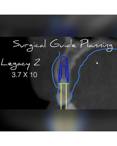 CBCT, Digital Workflow, and Guided Implant Surgery- Las Vegas, NV